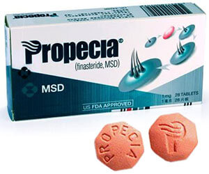 finasteride sin receta españa